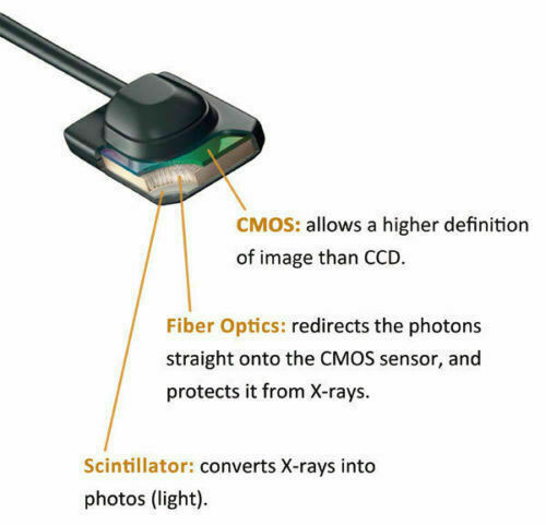 Digital X-rays for Dentistry